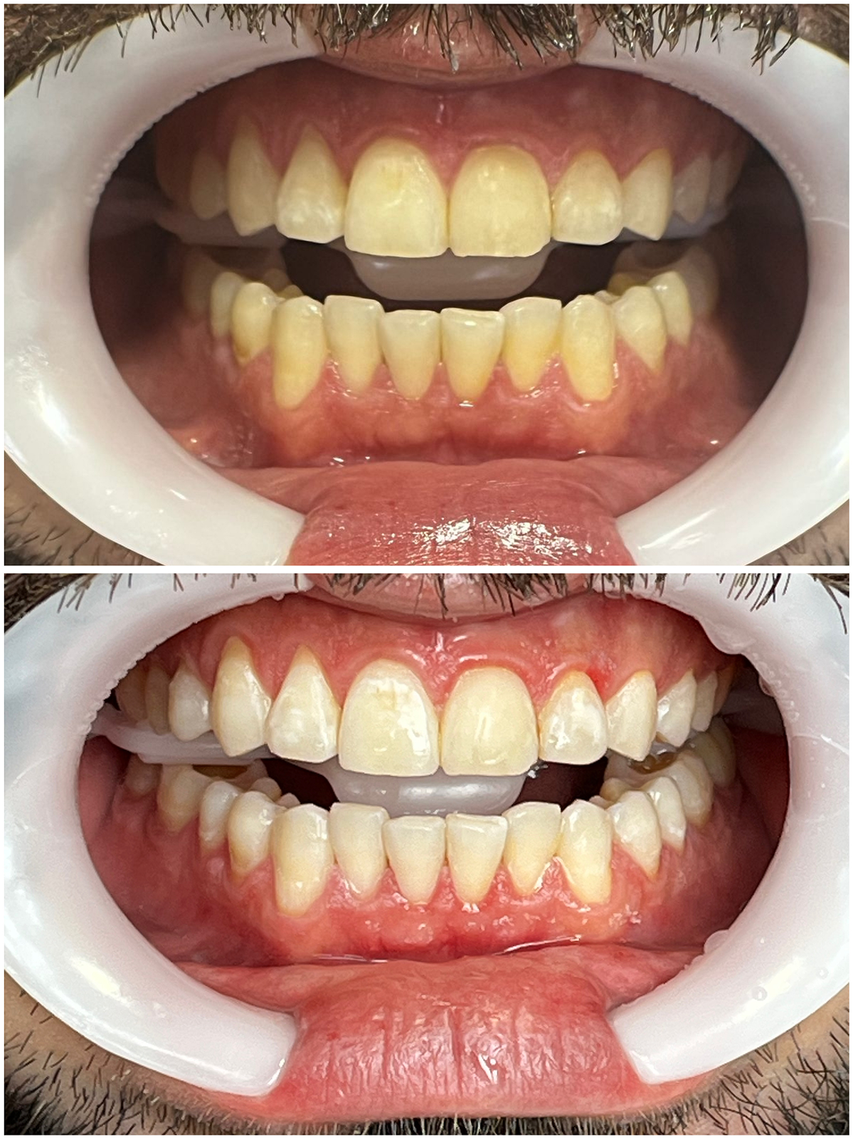 B53D2032-8B4A-4069-90A9-9693F5603331 1